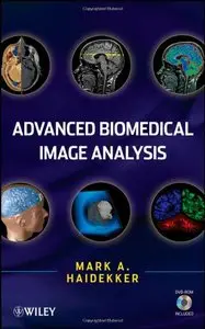 Advanced Biomedical Image Analysis (repost)