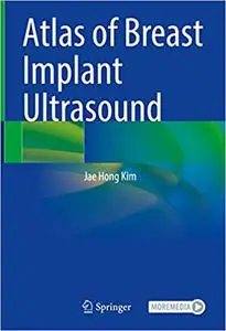 Atlas of Breast Implant Ultrasound