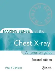 Making Sense of the Chest X-ray: A hands-on guide 2nd Edition (Instructor Resources)