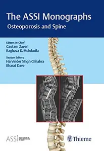 The ASSI Monographs Osteoporosis and Spine