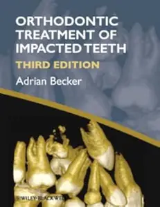 Orthodontic Treatment of Impacted Teeth (Repost)