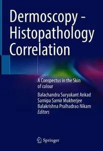 Dermoscopy - Histopathology Correlation: A Conspectus in the Skin of colour (Repost)