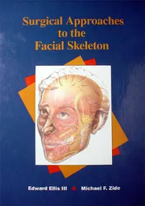 Surgical Approaches to the Facial Skeleton (repost)