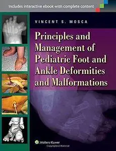 Principles and Management of Pediatric Foot and Ankle Deformities and Malformations [Repost]