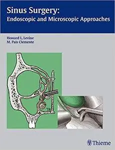 Sinus Surgery: Endoscopic and Microscopic Approaches (Repost)