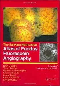 Atlas of Fundus Fluorescein Angiography
