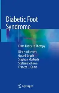 Diabetic Foot Syndrome: From Entity to Therapy (Repost)