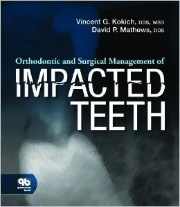 Orthodontic and Surgical Management of Impacted Teeth