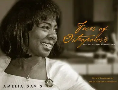 Faces of Osteoporosis: And the Stories Behind Them (Repost)