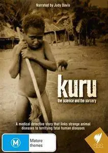 SBS - Kuru: The Science and the Sorcery (2010)