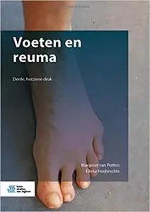 Voeten en reuma