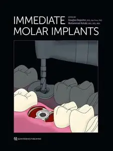 «Immediate Molar Implants» by Douglas Deporter, Mohammad Ketabi