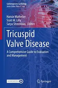 Tricuspid Valve Disease: A Comprehensive Guide to Evaluation and Management (Contemporary Cardiology)