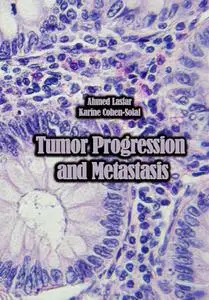 "Tumor Progression and Metastasis" ed. by Ahmed Lasfar,  Karine Cohen-Solal