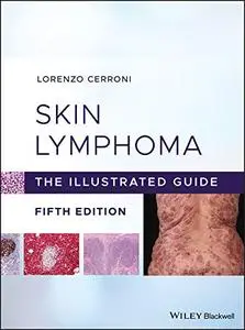 Skin Lymphoma: The Illustrated Guide