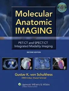 Molecular Anatomic Imaging: PET-CT and SPECT-CT Integrated Modality Imaging, 2nd Edition (repost)