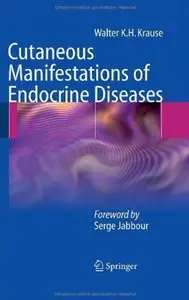 Cutaneous Manifestations of Endocrine Diseases [Repost]