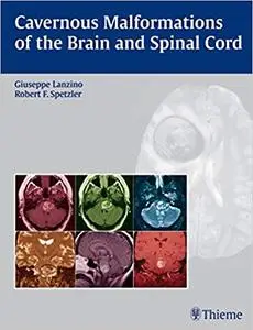 Cavernous malformations of the brain and spinal cord (Repost)