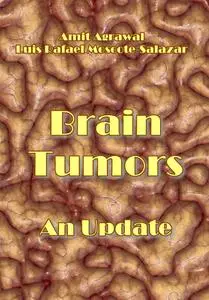 "Brain Tumors. An Update" ed. by Amit Agrawal, Luis Rafael Moscote-Salazar