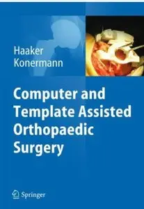 Computer and Template Assisted Orthopedic Surgery [Repost]