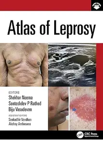 Atlas of Leprosy