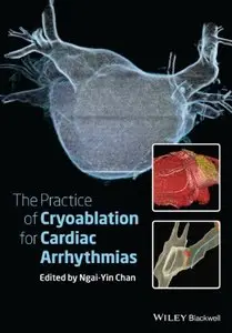 The Practice of Catheter Cryoablation for Cardiac Arrhythmias (repost)