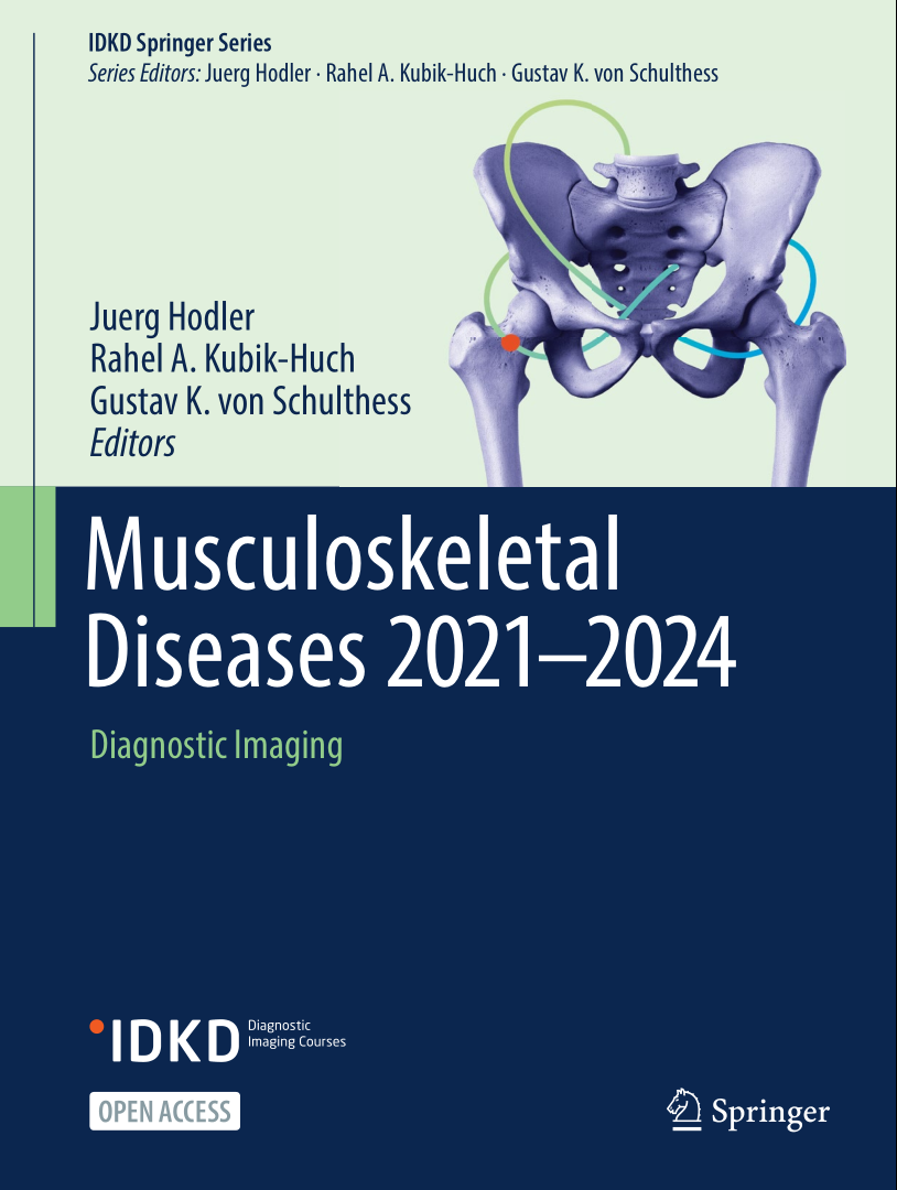 Musculoskeletal Diseases 20212024 / AvaxHome