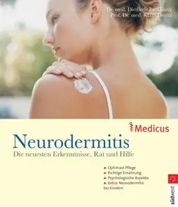 Neurodermitis: Die neusten Erkenntnisse, Rat und Hilfe
