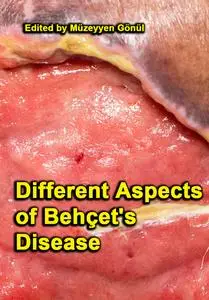 "Different Aspects of Behçet's Disease" ed. by Müzeyyen Gönül,  Arzu Kilic