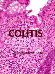 "Colitis" ed. by Masayuki Fukata