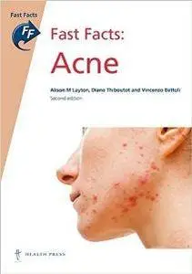 Fast Facts : Acne, Second Edition