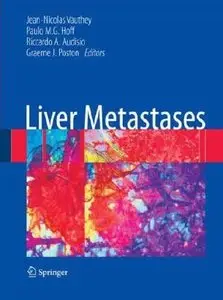 Liver Metastases