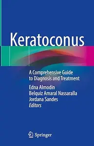 Keratoconus: A Comprehensive Guide to Diagnosis and Treatment