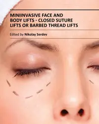 "Miniinvasive Face and Body Lifts: Closed Suture Lifts or Barbed Thread Lifts" ed. by Nikolay Serdev