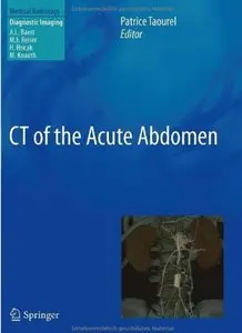 CT of the Acute Abdomen‎