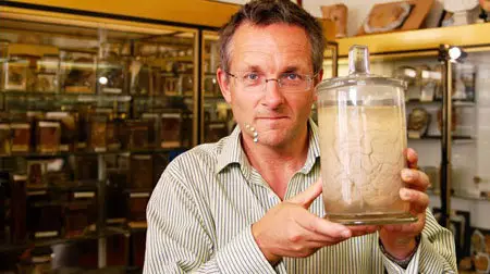 The Brain: A Secret History - Broken Brains (2011, part 3)