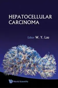 Hepatocellular Carcinoma by W. Y. Lau [Repost] 