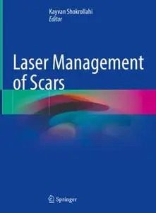 Laser Management of Scars (Repost)