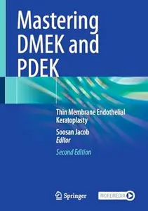 Mastering DMEK and PDEK (2nd Edition)