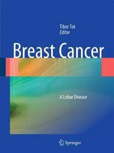 Breast Cancer: A Lobar Disease (Repost)