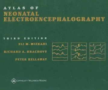 Atlas of Neonatal Electroencephalography, Third Edition (repost)
