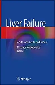 Liver Failure: Acute and Acute on Chronic