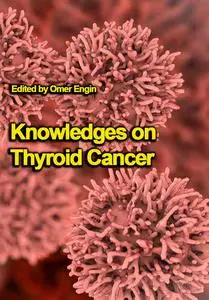 "Knowledges on Thyroid Cancer" ed. by Omer Engin