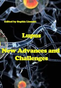 "Lupus: New Advances and Challenges" ed. by Sophia Lionaki