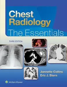 Chest Radiology: The Essentials (3rd Edition) (Repost)