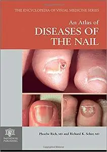 An Atlas of Deseases of the Nail (Repost)