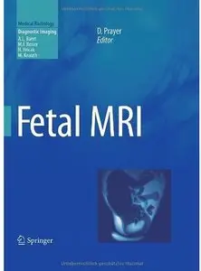 Fetal MRI