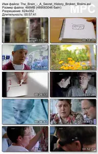 The Brain: A Secret History - Broken Brains (2011, part 3)