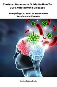 The Most Paramount Guide On How To Cure Autoimmune Diseases
