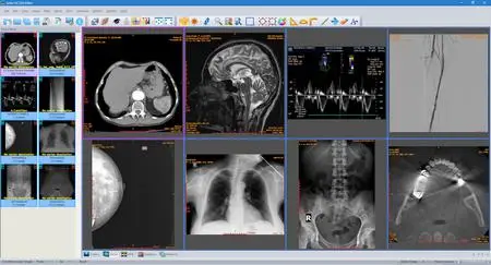 Sante DICOM Editor 7.9.4 Portable